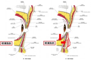 眼瞼　図　画像　セレクト美容塾